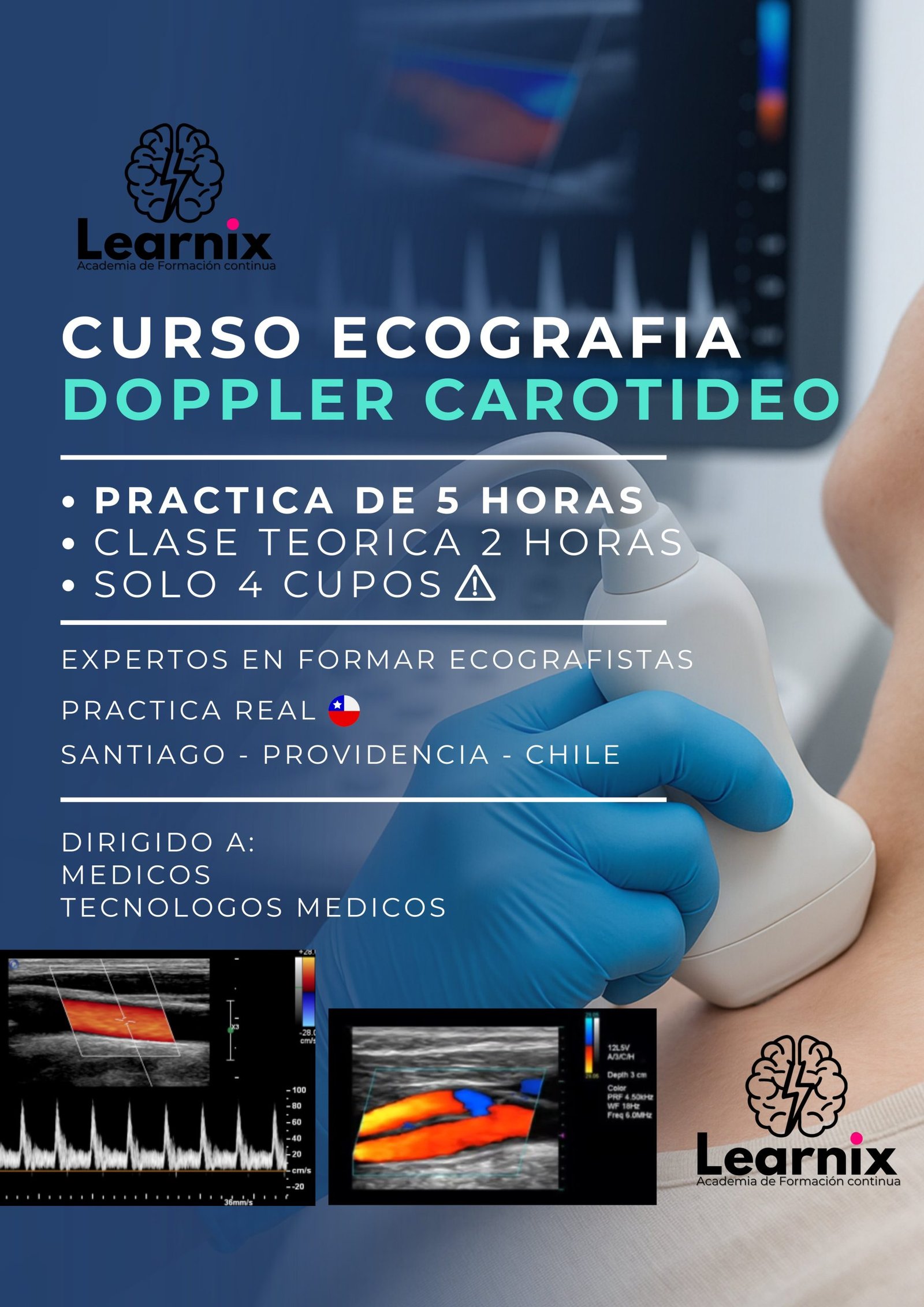 Ecografía Doppler Carotideo - Learnix